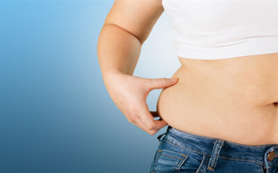 Bariatric Surgery Not Just for Obese also Overweight