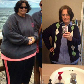 Aletha C. – Bariatrics Gastric Sleeve Surgery