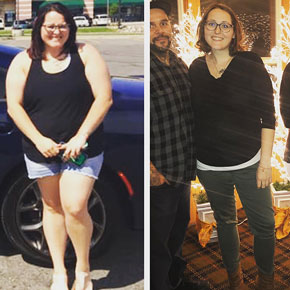 Megan W. – Bariatrics Gastric Sleeve Surgery