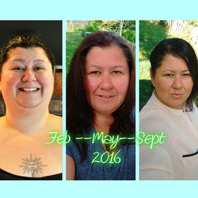 Natalie C. – Bariatrics Gastric Sleeve Surgery