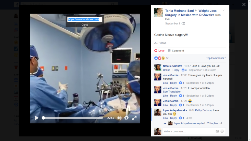 How to Save Your Facebook Live Streamed Surgery Video on Your Computer